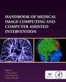 Handbook of Medical Image Computing and Computer Assisted Intervention