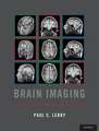 Brain Imaging: A Guide for Clinicians