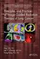 Principles and Practice of Image-Guided Radiation Therapy of Lung Cancer