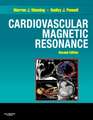 Cardiovascular Magnetic Resonance