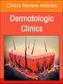 The Evolving Landscape of Atopic Dermatitis, An Issue of Dermatologic Clinics