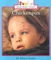 Chickenpox