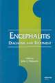 Encephalitis: Diagnosis and Treatment