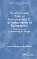 Clark's Essential Guide to Preliminary Clinical Evaluation of Musculoskeletal X-rays