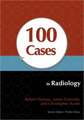 100 Cases in Radiology