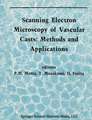 Scanning Electron Microscopy of Vascular Casts: Methods and Applications