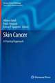 Skin Cancer: A Practical Approach