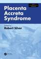 Placenta Accreta Syndrome