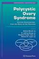 Polycystic Ovary Syndrome: Current Controversies, from the Ovary to the Pancreas