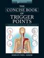 Concise Book of Trigger Points 3rd