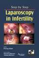 Step by Step Laparoscopy in Infertility