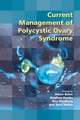 Current Management of Polycystic Ovary Syndrome