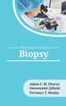 Biopsy