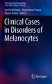 Clinical Cases in Disorders of Melanocytes