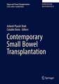 Contemporary Pancreas and Small Bowel Transplantation