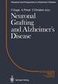 Neuronal Grafting and Alzheimer’s Disease