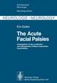 The Acute Facial Palsies: Investigations on the Localization and Pathogenesis of Meato-Labyrinthine Facial Palsies