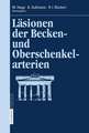 Läsionen der Becken- und Oberschenkelarterien