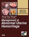 Step by Step: Management of Abnormal Uterine Hemorrhage