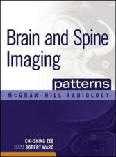 Brain and Spine Imaging Patterns