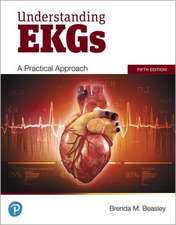 Beasley, B: Understanding EKGs