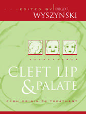 Cleft Lip and Palate: From Origin to Treatment