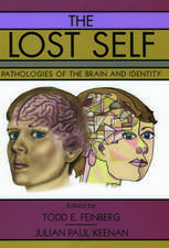 The Lost Self: Pathologies of the Brain and Identity