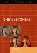 The Dystonias