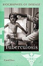 Tuberculosis