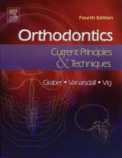 Orthodontics: Current Principles and Techniques