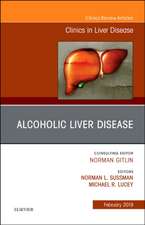 Alcoholic Liver Disease, An Issue of Clinics in Liver Disease