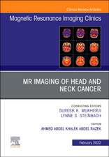 MR Imaging of Head and Neck Cancer, An Issue of Magnetic Resonance Imaging Clinics of North America