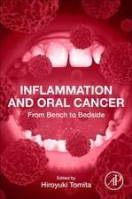 Inflammation and Oral Cancer: From Bench to Bedside