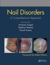 Nail Disorders: A Comprehensive Approach