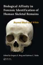 Biological Affinity in Forensic Identification of Human Skeletal Remains: Beyond Black and White