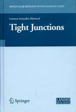 Tight Junctions