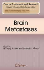 Brain Metastases