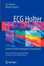 ECG Holter: Guide to Electrocardiographic Interpretation