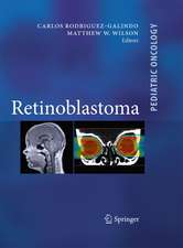 Retinoblastoma