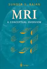 MRI: A Conceptual Overview