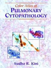 Color Atlas of Pulmonary Cytopathology