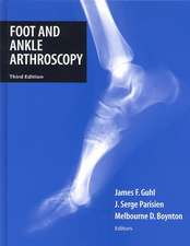 Foot and Ankle Arthroscopy