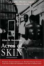 Acres of Skin: Human Experiments at Holmesburg Prison