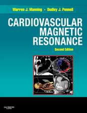 Cardiovascular Magnetic Resonance