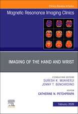 Imaging of the Hand and Wrist, An Issue of Magnetic Resonance Imaging Clinics of North America