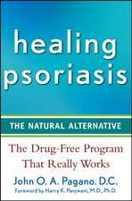 Healing Psoriasis: The Natural Alternative