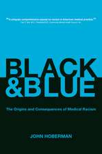 Black and Blue – The Origins and Consequences of Medical Racism