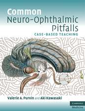 Common Neuro-Ophthalmic Pitfalls: Case-Based Teaching