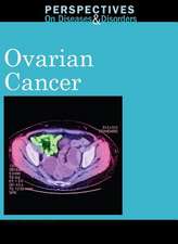 Ovarian Cancer