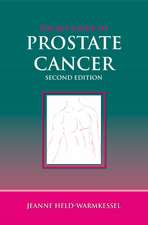 Pocket Guide to Prostate Cancer